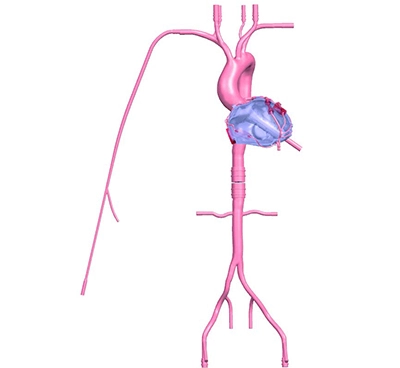 3d coronary artery model