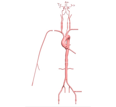 circle of willis brain simulation model