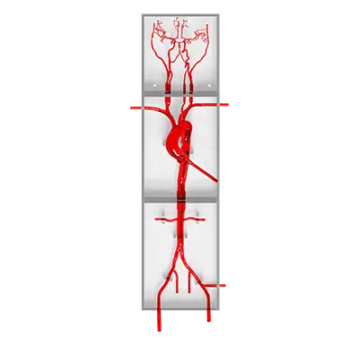 circle of willis model