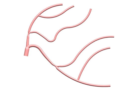 drawing of planar left coronary vessel model radial artery approach