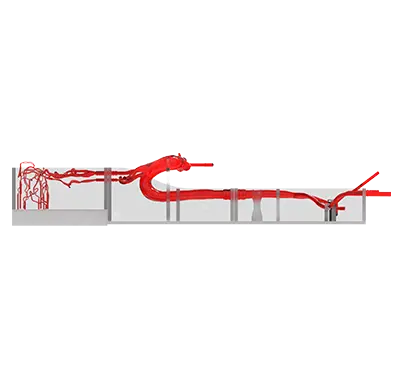 intracranial vascular simulation