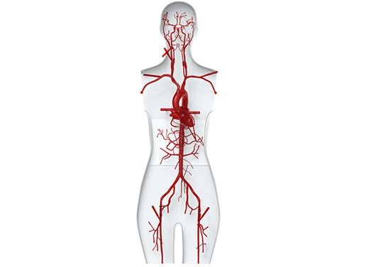 vascular model
