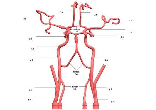 drawing of intracranial vascular model preclinic