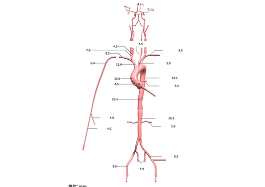 drawing of intracranial vascular model