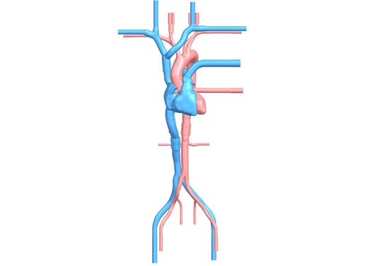 drawing of cardiac intervention simulation model