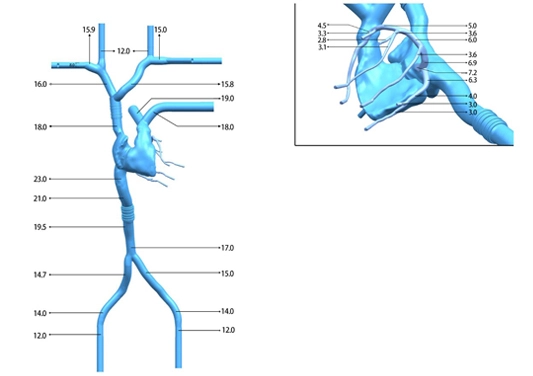 drawing of cardiac veins simulation models