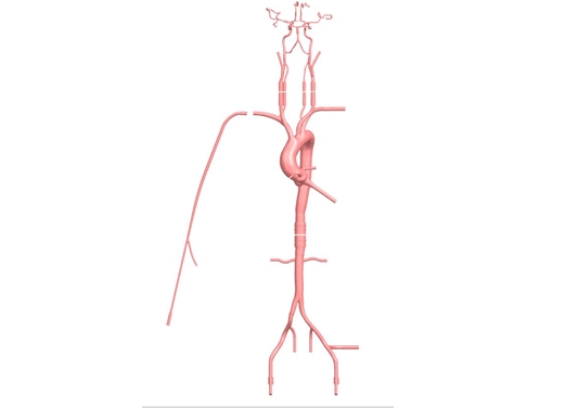 drawing of intracranial vascular model