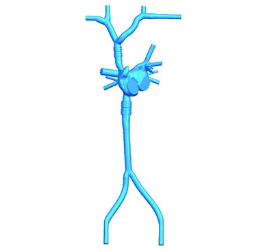 transseptal puncture vessel model