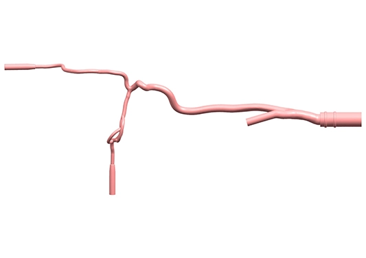 drawing of anterior cerebral circulation vessel model