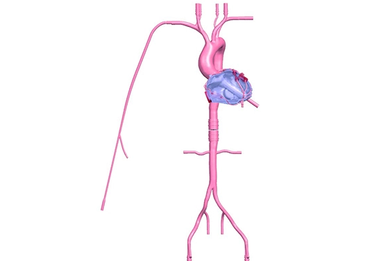 drawing of preclinic coronary artery simulation model