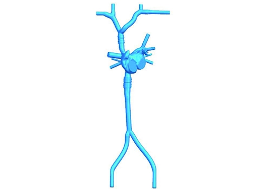 drawing of preclinic transseptal puncture vessel model