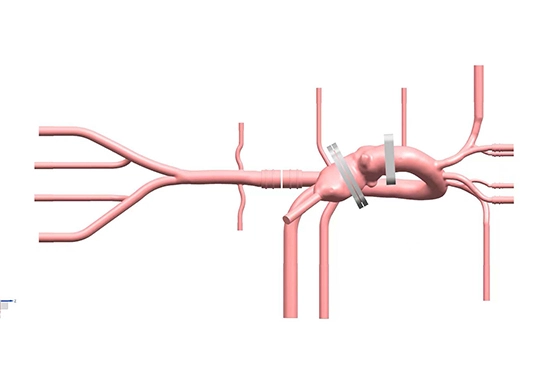 drawing of tavr simulation model