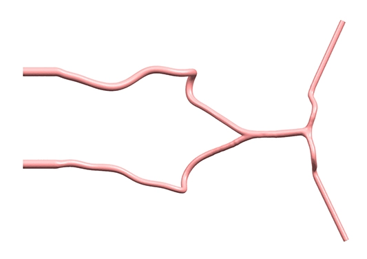 posterior cerebral circulation vessel model of preclinic
