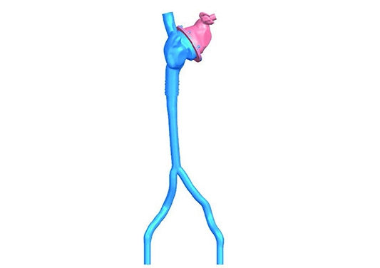drawing of left atrial appendage vessel model